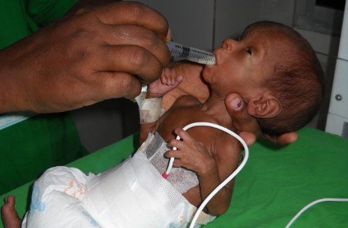 Un bebé prematuro al que están alimentando