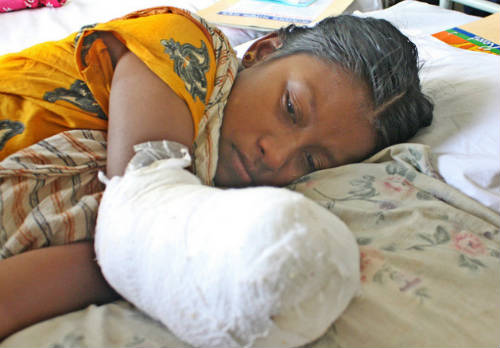 Razia perdió un brazo en el accidente de Rana Plaza
