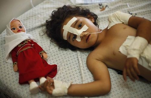 Una niña herida en el hospital con su muñeca al lado