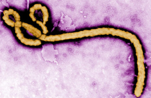 Virus del ébola al microscopio, una especie de gusano largo