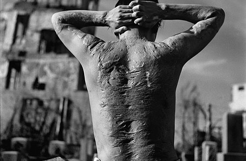 Un hombre con el torso desnudo y la piel dañada por la explosión nuclear