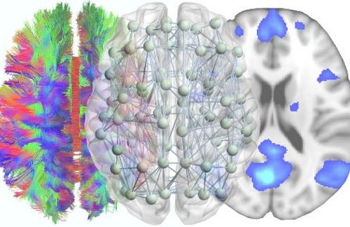 Tres imágenes del cerebro humano