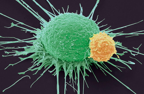 Un linfocito y una célula de cáncer